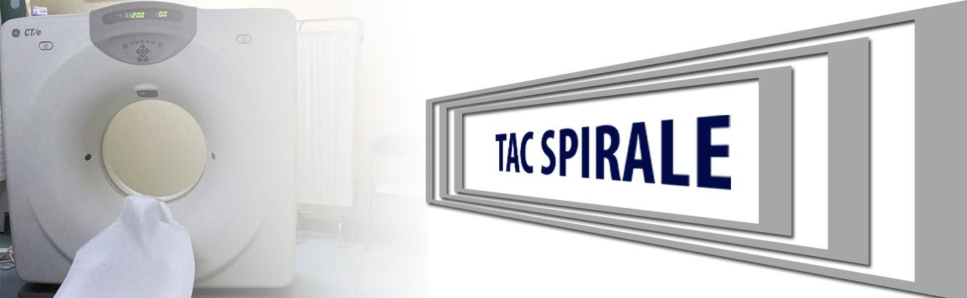 TAC_SPIRALE2